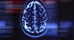 An MRI scan of a human brain (file image). One concern on this new frontier of technology is the ethics behind using human cells to create a 'biological computer'