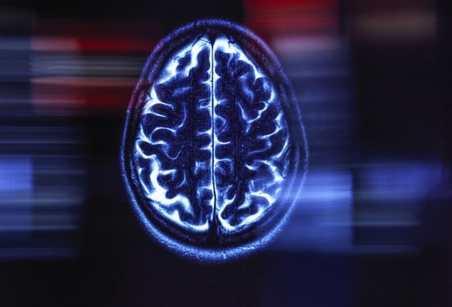 An MRI scan of a human brain (file image). One concern on this new frontier of technology is the ethics behind using human cells to create a 'biological computer'