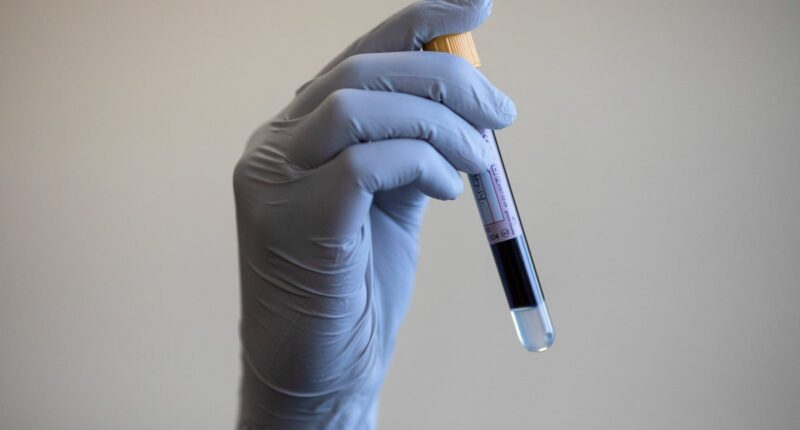 Cancer-detecting blood test ‘feasible at scale’ on NHS