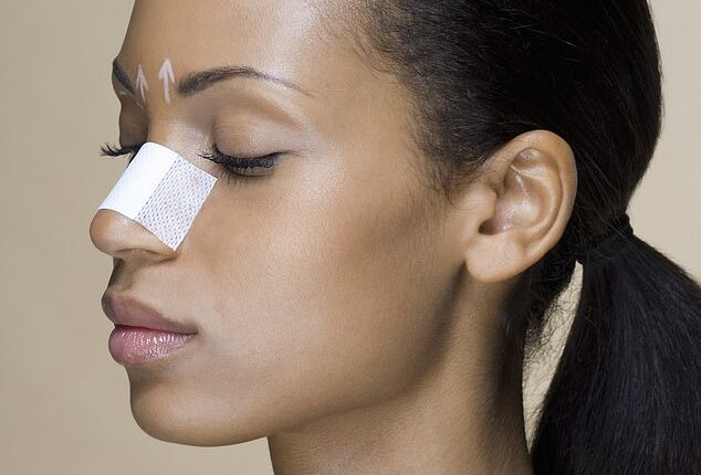Nasal strips can work well