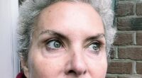 Coronation Street actress Tracy Shaw said she is struggling in emotional update after undergoing her first chemotherapy session following her breast cancer diagnosis