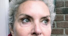 Coronation Street actress Tracy Shaw said she is struggling in emotional update after undergoing her first chemotherapy session following her breast cancer diagnosis
