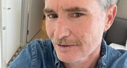 Dave Hughes (pictured) has shared his battle with skin cancer, revealing on Thursday that he has had five cancerous lesions removed