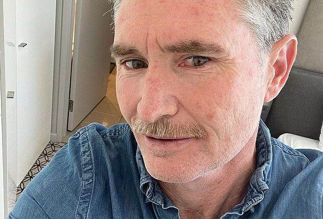 Dave Hughes (pictured) has shared his battle with skin cancer, revealing on Thursday that he has had five cancerous lesions removed