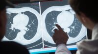 Doctors hail cancer injection that can destroy entire tumors