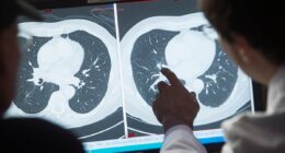 Doctors hail cancer injection that can destroy entire tumors
