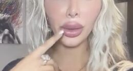 Farrah Abraham is suffering from a 'degenerative disc disease' in her jaw that's left her unable to open her mouth properly and requires surgery to fix