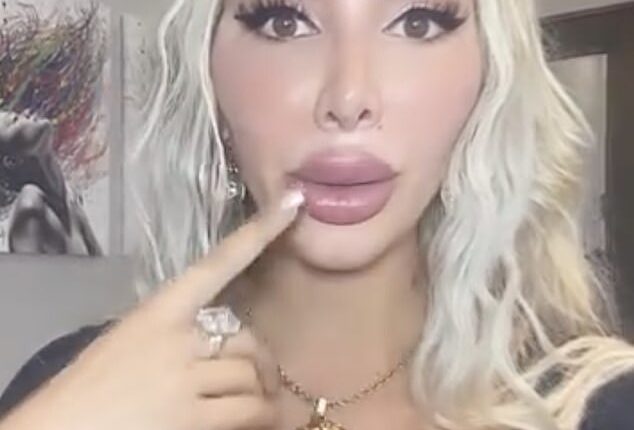 Farrah Abraham is suffering from a 'degenerative disc disease' in her jaw that's left her unable to open her mouth properly and requires surgery to fix