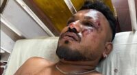 Vishwash Kumar Ramesh was the sole survivor of the crash. He is suffering from severe Post-Traumatic Stress Disorder