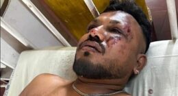 Vishwash Kumar Ramesh was the sole survivor of the crash. He is suffering from severe Post-Traumatic Stress Disorder