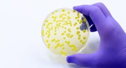 Officials say they are working to establish the cause of the outbreak (stock image)