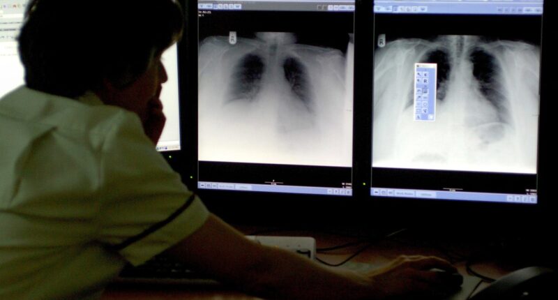 New dual-action drug a ‘promising step forward’ for patients with hard-to-treat lung cancer