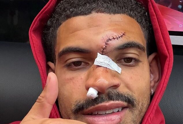 Nottingham Forest are exploring the possibility of Morgan Gibbs-White wearing a mask for Thursday's huge Europa League clash with Aston Villa
