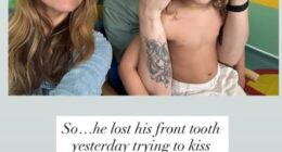 Professor Green has revealed that he has rushed his five-year-old son to hospital after suffering a painful accident on holiday on Wednesday