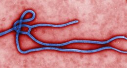 U.S. Establishes African Ebola Facility to Quarantine Infected Americans. – The National Pulse
