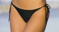 Labiaplasty is fast becoming a plastic surgery trend among the one percent
