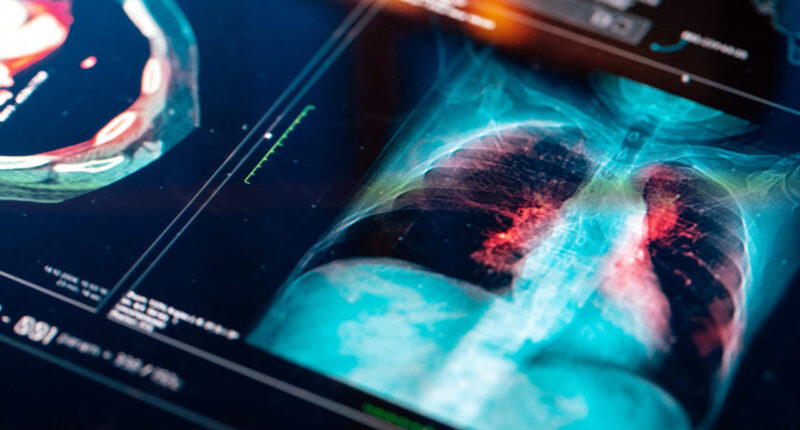 An experimental lung-cancer drug could replace Keytruda one day. But investors aren’t wowed.