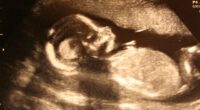 Dem State Law Requires Schools and Colleges to Hand Out Abortion Drugs. – The National Pulse