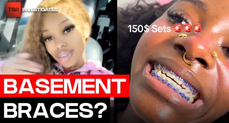 Basement Braces Are Going Viral And Dentists Are Concerned