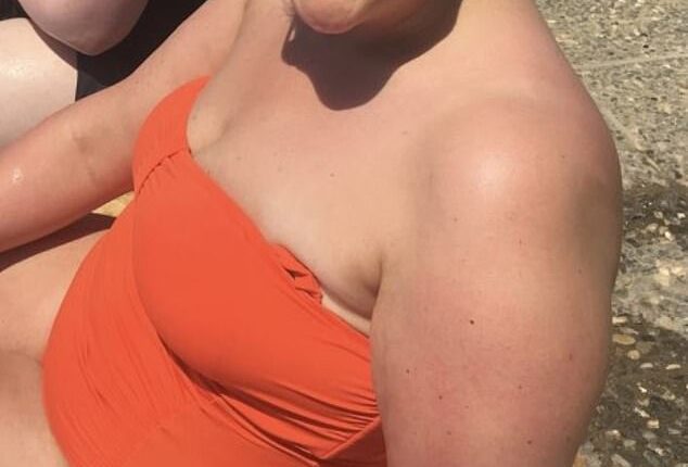 Emily Larner in Greece in 2019, weighing 17-and-a-half stone and wearing her flesh-covering bright orange swimsuit. ¿I felt deeply uncomfortable in my own skin,¿ she says