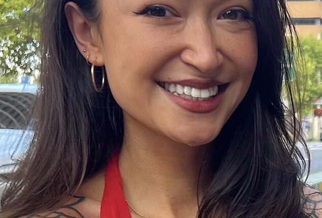 For years, 31-year-old Sophie Anne from London was plagued by a high-pitched ringing in her ears and sharp, shooting pain in her jaw
