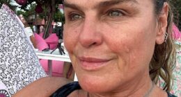 'Once I hit 50, the wrinkles and skin tone really were noticeable and the change in my face as it all drops and spreads was obvious,' says Belinda Gavin (pictured before her treatment)