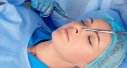 An influencer was shocked to discover a horrifying, little-known side effect after undergoing a nose job - but according to plastic surgeons, it's not as scary as it may seem (stock image)