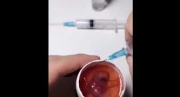 Man Successfully Grows A Chicken In An Open Egg And Gets It On Video – TVovermind