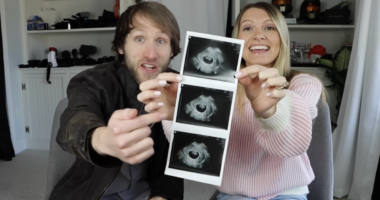 Media Shrug At Aborting Down Syndrome Baby But Cry ‘Eugenics’ At Sydney Sweeney’s Jugs