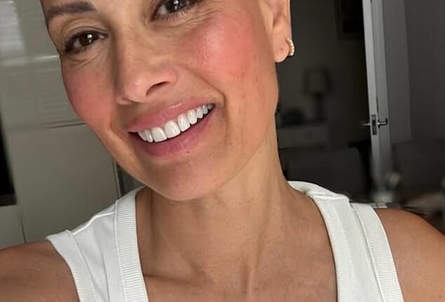 Melanie Sykes has shown off her completely bald head days after revealing she had lost 'two-thirds' of her hair