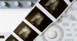 Ultrasound photos.