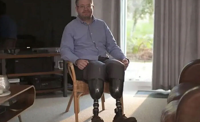 Professional Surgeon Thrown In Prison After Getting His Legs Amputated To Fulfill Intimate Desire And Lying