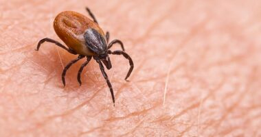 Lyme disease is a tick-borne illness typically caused by the bacterium Borrelia burgdorferi transmitted by a deer tick. Borrelia mayonii is also transmitted by the deer tick, but in far rarer cases