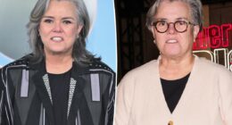 Rosie O’Donnell explains why she decided to reveal secret facelift