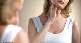 As oestrogen declines, the skin naturally becomes thinner, drier and less resilient