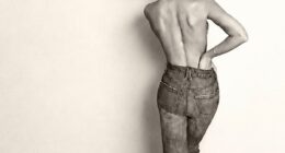 Cruz Beckham's girlfriend Jackie Apostel told fans to embrace their scars as she posed topless to mark two years since she had extensive spinal surgery
