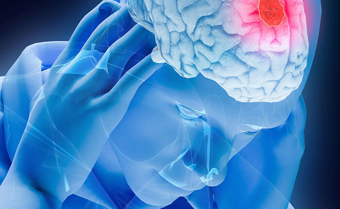 Man&rsquo;s Suspected Brain Cancer Turns Into A Horror Story As Medical Team Uncovers Something Far Creepier