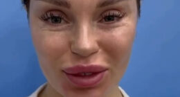 Woman&rsquo;s Post-Plastic Surgery Photos Divide The Internet As She And Her Surgeon Celebrate The Results